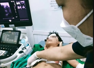 Một nạn nhân đang được cấp cứu tại bệnh viện.