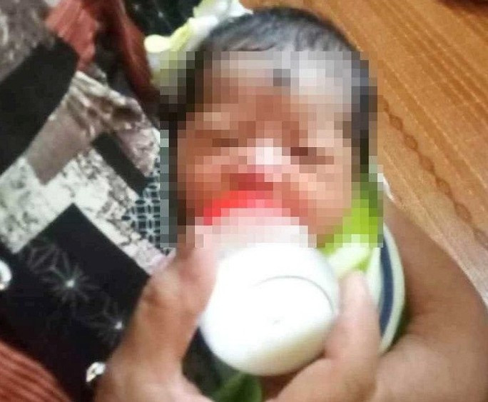 Bé gái sơ sinh được phát hiện tại sân chùa Thuần Hậu.