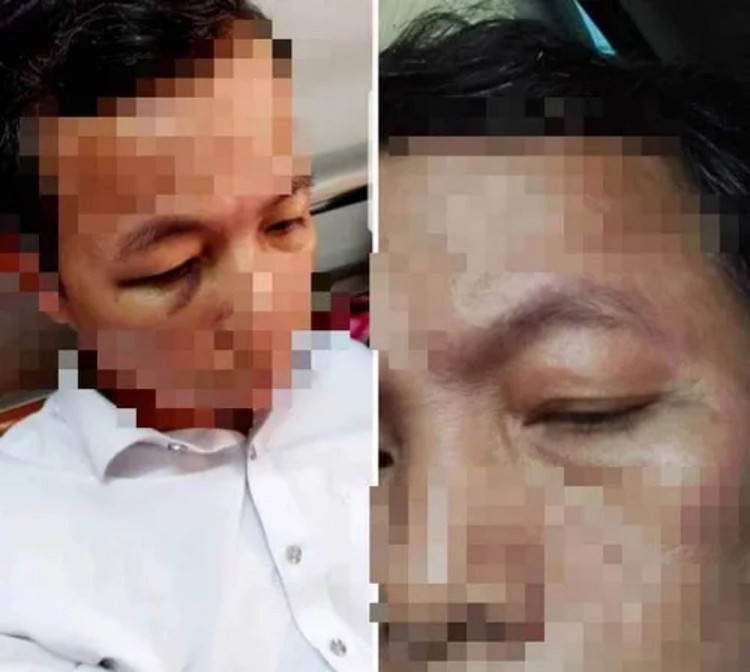 Ông Lê Đức Huấn bị đánh trọng thương phải nhập viện.