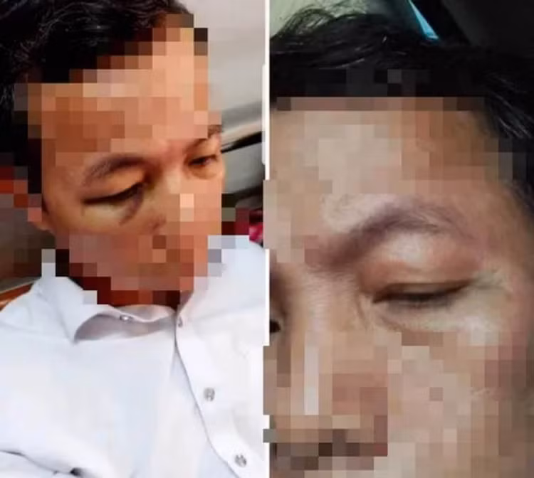 Ông Lê Đức Huấn bị đánh trọng thương phải nhập viện.