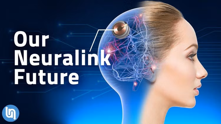 Cay chip vao nao nguoi: Cong nghe vien tuong dang tro thanh hien thuc-Hinh-2