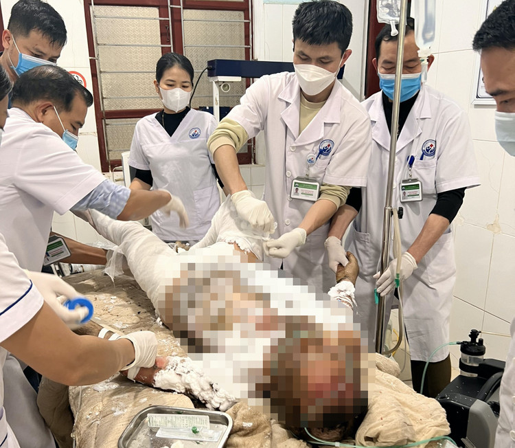Ông V.B.X. bị bỏng toàn thân.