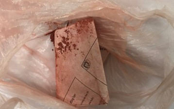 Gói thuốc cam được gia đình dùng rơ lưỡi cho bệnh nhi 1 tuổi 3 - 4 lần mỗi ngày.