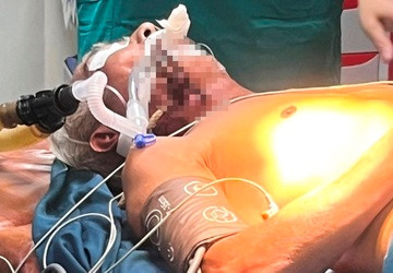 Ông V.C.Đ. đang được các bác sỹ phẫu thuật lấy dị vật ra.