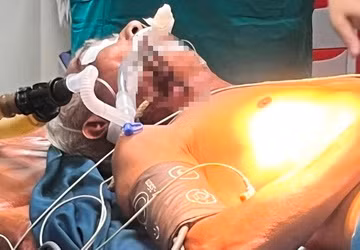 Ông V.C.Đ. đang được các bác sỹ phẫu thuật lấy dị vật ra.