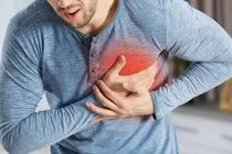 Chết đột ngột, đột tử do bệnh tim có phải đột quỵ không?