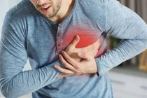Chết đột ngột, đột tử do bệnh tim có phải đột quỵ không?
