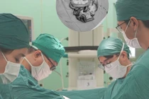 Đau bụng dữ dội người đàn ông phải cắt 5m ruột hoại tử vì tắc động mạch treo