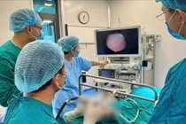 Bé sơ sinh 32 ngày tuổi mắc u nang hố lưỡi thanh thiệt khổng lồ hiếm gặp