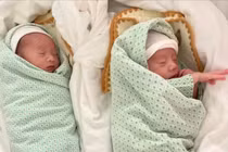 Chẩn đoán trước sinh sớm, hội chẩn liên viện giữ song thai an toàn