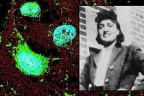 Tế bào bất tử của Henrietta Lacks, đằng sau cuộc chiến pháp lý kéo dài
