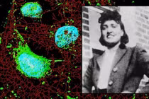 Tế bào bất tử của Henrietta Lacks, đằng sau cuộc chiến pháp lý kéo dài
