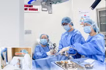 Laser CO2 vi phẫu qua đường miệng điều trị ung thư dây thanh