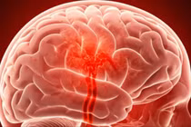 6 loại thực phẩm giúp não 'dễ thở', giảm hoa mắt, chóng mặt