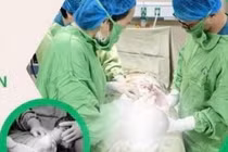 Gỡ 4 vòng dây rốn đón em bé chào đời an toàn