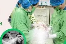 Gỡ 4 vòng dây rốn đón em bé chào đời an toàn