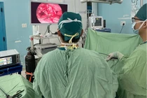 Nội soi cứu bé trai 3 tuổi khỏi ổ áp xe bụng khổng lồ do vỡ ruột thừa