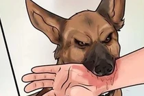 Bé trai 13 tuổi sốc nhiễm khuẩn sau 2 tháng bị chó cắn 