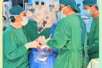 Cứu bệnh nhi tổn thương mạch máu Moyamoya do biến chứng sau xạ trị u sọ hầu