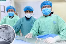 Sau 14 năm đặt 4 stent, cụ ông 76 tuổi choáng tim, suy hô hấp