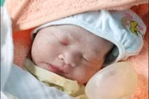 Cứu hai mẹ con thai phụ 35 tuần rau bong non nguy kịch