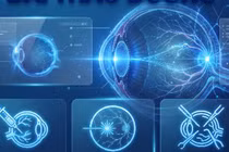 Giảm thị lực, nhìn mờ người bệnh đái tháo đường cẩn thận bệnh võng mạc