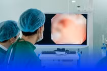 Ăn ngon, ngủ tốt, không đau bụng, người đàn ông sốc khi tiền ung thư dạ dày