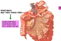 Chữa thành công bệnh hiếm gây tắc nghẽn ruột bằng phẫu thuật tại TP HCM