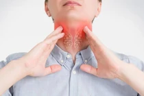 Các bước đơn giản để giảm nguy cơ ung thư vòm họng