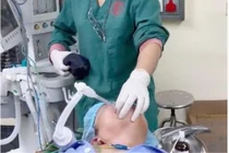 Vẹo, xoắn cột sống cổ dễ thất bại khi đặt nội khí quản để phẫu thuật