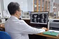 Từ vài quả bóng cười cho vui đến liệt nửa người, bác sĩ cảnh báo