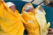 Mổ đẻ thành công ca sinh 3 tự nhiên hiếm gặp cho sản phụ 32 tuổi