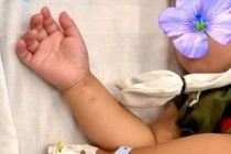 Tưởng kẹo thạch, trẻ hơn 2 tuổi uống nhầm thuốc diệt nấm