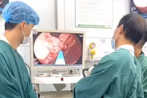 Đi ngoài phân đen, người đàn ông vỡ giãn tĩnh mạch, máu chảy thành tia