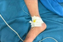 Nhiều trẻ tổn thương gan do dùng thuốc hạ sốt quá liều