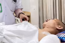 Chở 3 người ngã vào đống sắt, quý ông 35 tuổi lòi toàn bộ nội tạng