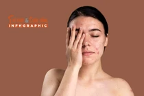 [INFOGRAPHIC] Bệnh về da thường gặp trong mùa hè