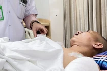 Chở 3 người ngã vào đống sắt, quý ông 35 tuổi lòi toàn bộ nội tạng