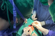 Cẩn thận u nang bì mắt gây biến dạng xương, ảnh hưởng thị lực