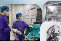 Chấn thương bụng kín dễ vỡ lách đe dọa tính mạng