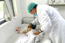 Đoạn ruột dài 12cm chứa đầy tóc gây tắc ruột ở bé gái 4 tuổi