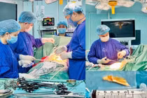 Đau bụng dữ dội cụ ông 80 tuổi bị xương cá đâm thủng ruột non