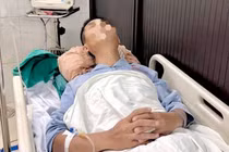 Thử thách gây tê tủy sống cho người bệnh có cột sống cong gù cứng như khúc gỗ