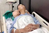 Thử thách gây tê tủy sống cho người bệnh có cột sống cong gù cứng như khúc gỗ