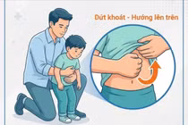 Ngày Tết đừng để hạt dưa, kẹo trở thành mối nguy cho trẻ