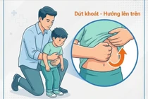 Ngày Tết đừng để hạt dưa, kẹo trở thành mối nguy cho trẻ