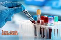 [Infographic] Các xét nghiệm định kỳ quan trọng để bảo vệ sức khỏe