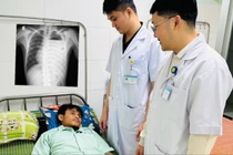 Đau ngực trái, thanh niên 20 tuổi nguy kịch vì tràn mủ, tràn khí màng phổi