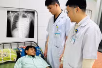 Đau ngực trái, thanh niên 20 tuổi nguy kịch vì tràn mủ, tràn khí màng phổi