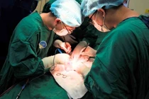  Vết loét không điều trị, mất toàn bộ "cậu nhỏ" vì ung thư